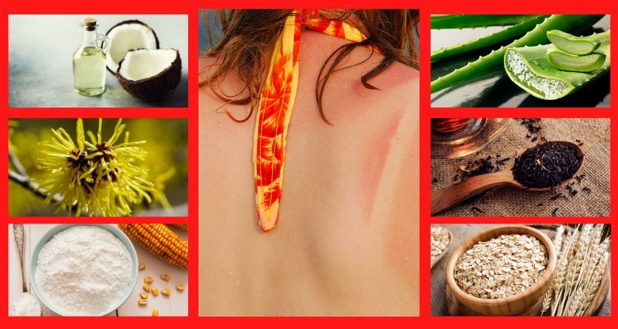 natural remedies for sunburn pain relief